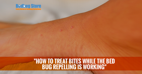 How To Treat Bites While the Bed Bug Repellent Is Working